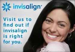 Invisalign Clear Braces for Monroe OK